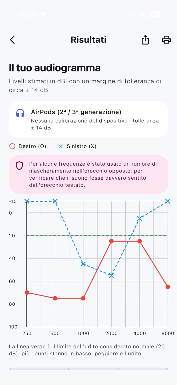 Il risultato del test: l'audiogramma